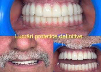 Clinica Dentară Dr. Alexandru Năstase - Implant Dentar Mioveni - Dinti Ficsi Mioveni